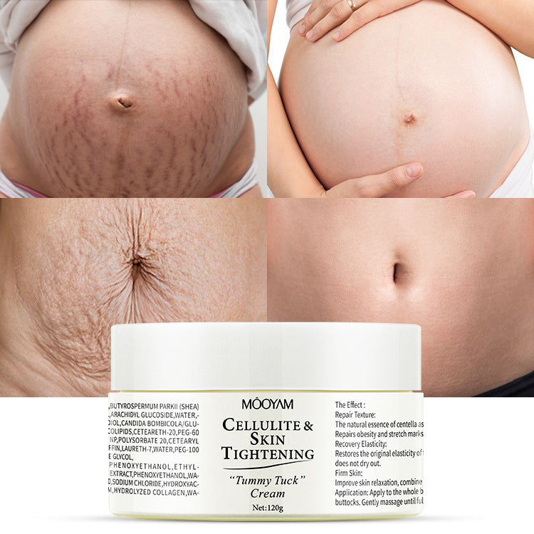 Firming & Nourishing Stretch Mark Care Cream