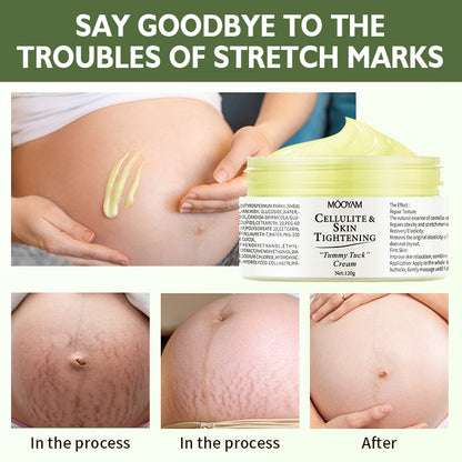 Firming & Nourishing Stretch Mark Care Cream