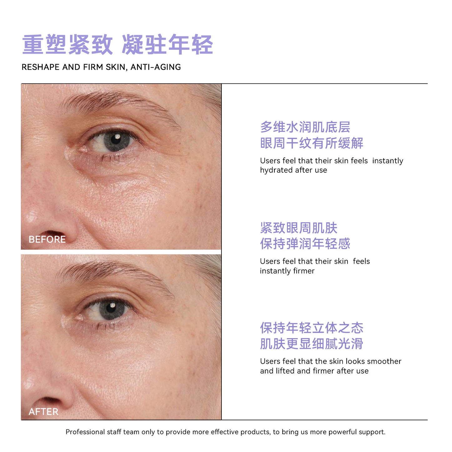 Retinol Eye Lift Cream - 1% Bakuchiol Formula to Fade Fine Lines & Deep Wrinkles