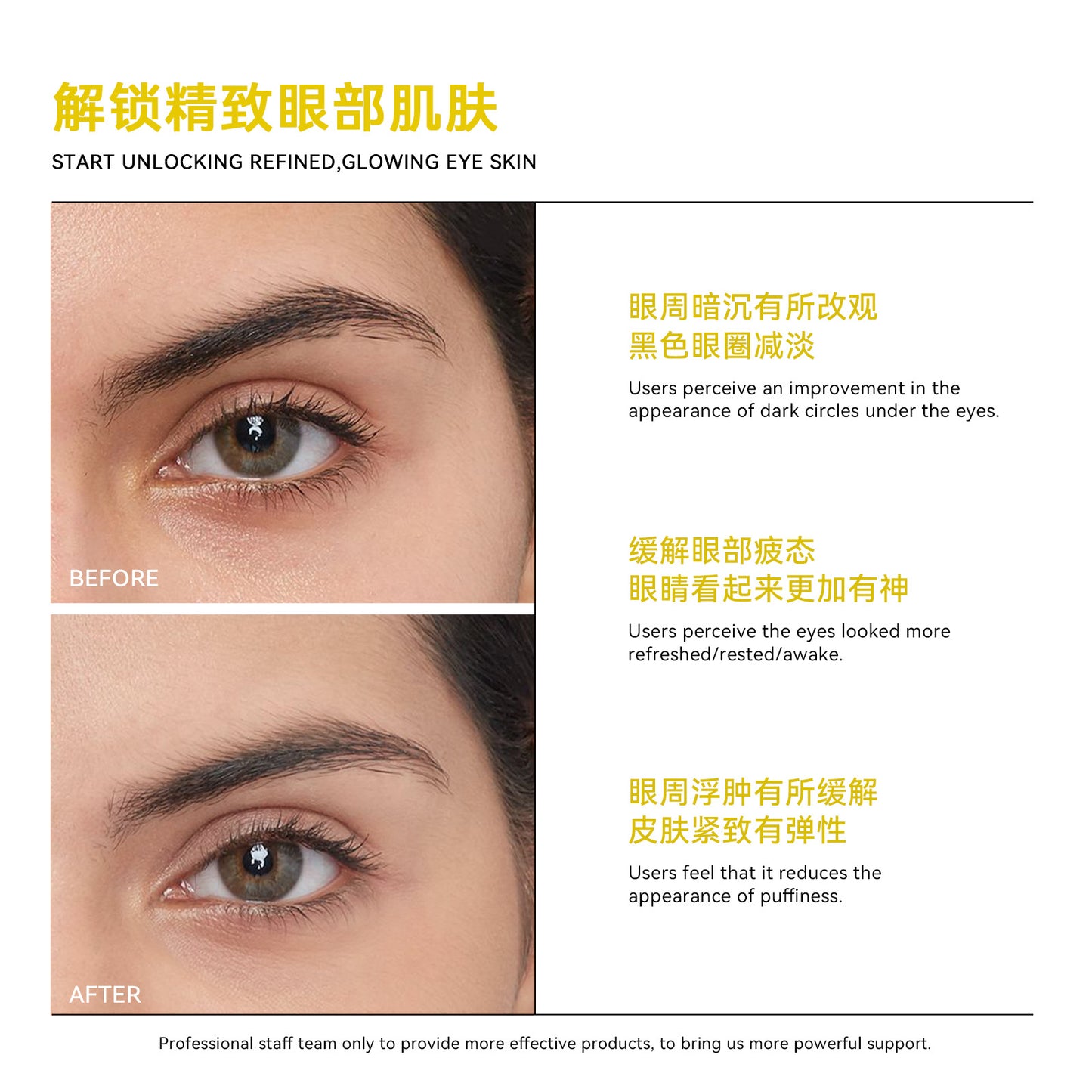 Vitamin C + Caffeine Radiant Eye Cream (15g) - Brightens, Depuffs & Hydrates