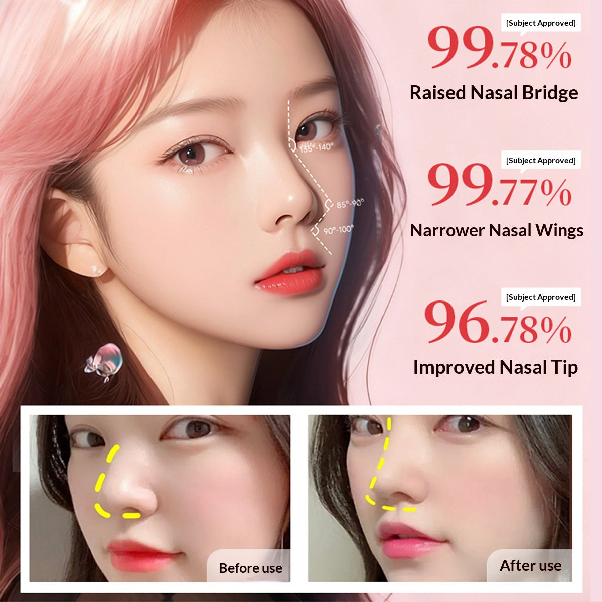 Hydroxyapatite Bone-Like Filler (50ml) | High-Precision Structural Support for Nose & Brows