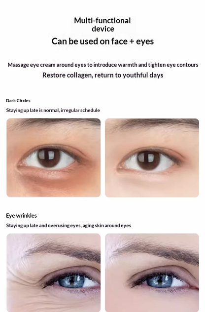Professional Collagen Induction Beauty Instrument – Eye & Face Lifting, Wrinkle Smoothing, Under-Eye Bag Reducer