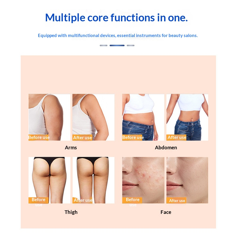 40K Ultrasonic Cavitation + Vacuum Roller | Body Shaper Massager